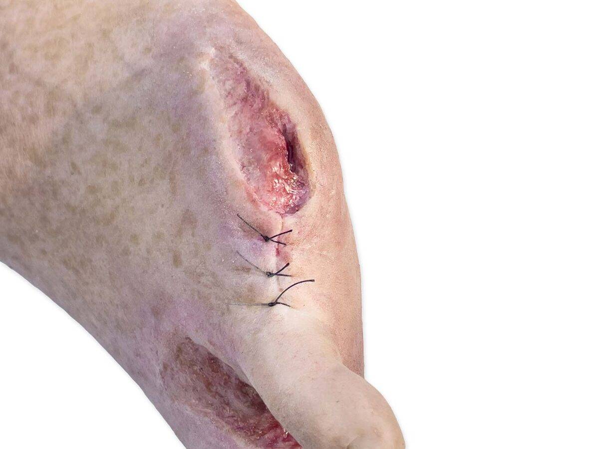 Das „Sockelmodell Zwei-Zehen-Fuß mit 6 Wunden“ von MEDICAL FX Germany präsentiert eine detailreiche Darstellung eines Fußes mit zwei verbliebenen Zehen und sechs verschiedenen Wun…