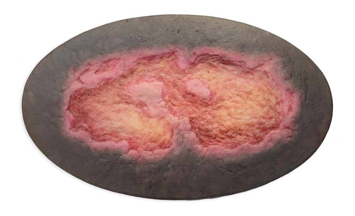 Das Modell „Stick-On Large Ulcus Cruris" von MEDICAL FX Germany simuliert ein großflächiges Unterschenkelgeschwür, typisch für venöse Insuffizienzen oder andere zirkulatorische Er…