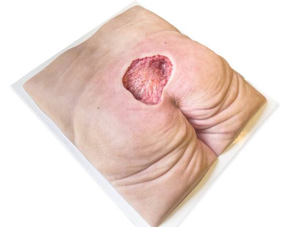 Das „Rahmenmodell Gesäß-Dekubitus" von MEDICAL FX Germany ist eine präzise Nachbildung eines fortgeschrittenen Druckgeschwürs im Sakralbereich, gefertigt aus hochwertigem Silikon.…