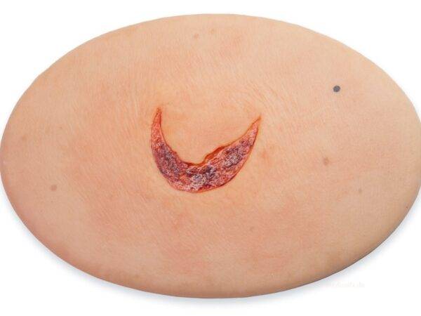 Das „Stick-On Medium Offene Ablederung" (Skin Tears)-Modell von MEDICAL FX Germany ist ein spezialisiertes, mittelgroßes Silikonmodell, das die Herausforderungen in der Behandlung…