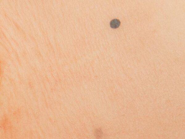 Das „Stick-On Medium Offene Ablederung" (Skin Tears)-Modell von MEDICAL FX Germany ist ein spezialisiertes, mittelgroßes Silikonmodell, das die Herausforderungen in der Behandlung…