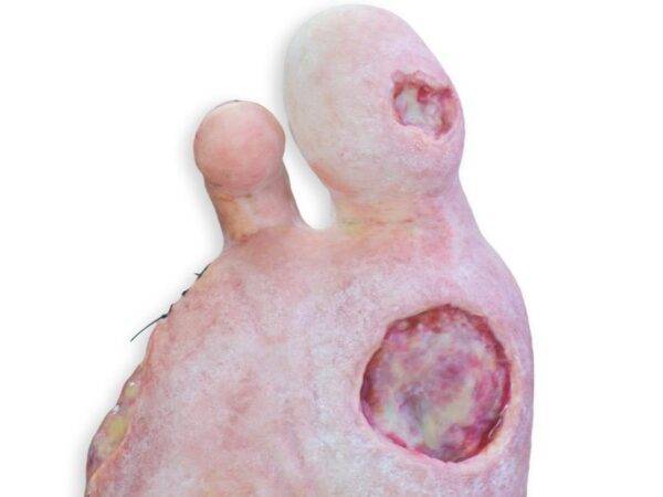 Das "Sockelmodell Bein mit 7 flachen Wunden" von MEDICAL FX Germany ist ein exzellentes Lehr- und Übungsinstrument für medizinisches Fachpersonal, um ein breites Spektrum an Wundv…