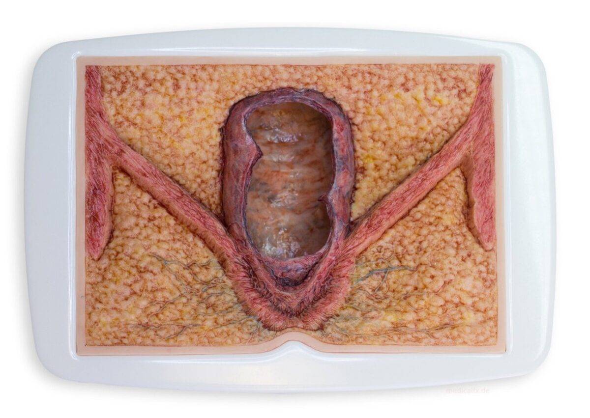 Das „Rahmenmodell Enddarm-Simulator“ von MEDICAL FX Germany ist ein hochwertiges, realistisches Trainingsmodell, das speziell für medizinische Schulungen und Übungen entwickelt wu…