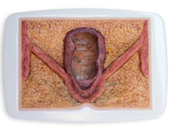 Das „Rahmenmodell Enddarm-Simulator“ von MEDICAL FX Germany ist ein hochwertiges, realistisches Trainingsmodell, das speziell für medizinische Schulungen und Übungen entwickelt wu…