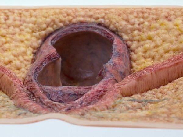 Das „Rahmenmodell Enddarm-Simulator“ von MEDICAL FX Germany ist ein hochwertiges, realistisches Trainingsmodell, das speziell für medizinische Schulungen und Übungen entwickelt wu…