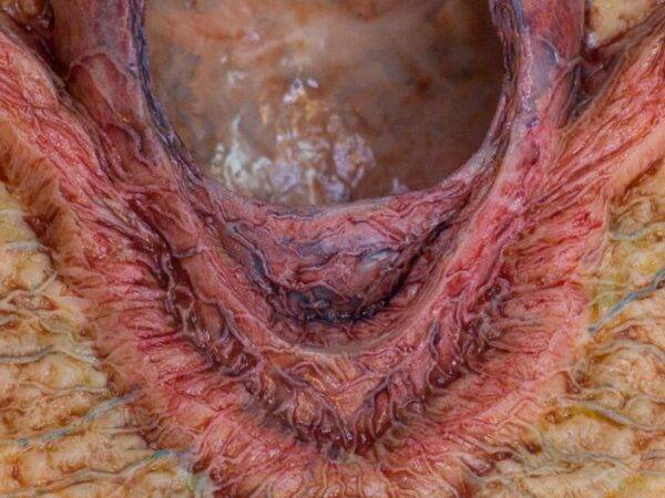 Das „Rahmenmodell Enddarm-Simulator“ von MEDICAL FX Germany ist ein hochwertiges, realistisches Trainingsmodell, das speziell für medizinische Schulungen und Übungen entwickelt wu…