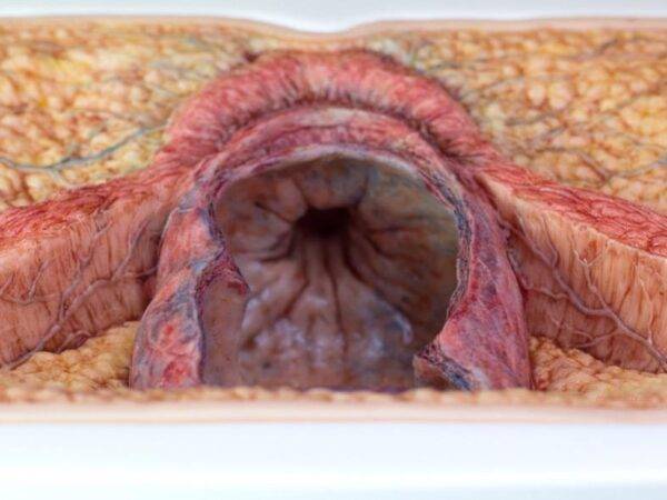 Das „Rahmenmodell Enddarm-Simulator“ von MEDICAL FX Germany ist ein hochwertiges, realistisches Trainingsmodell, das speziell für medizinische Schulungen und Übungen entwickelt wu…