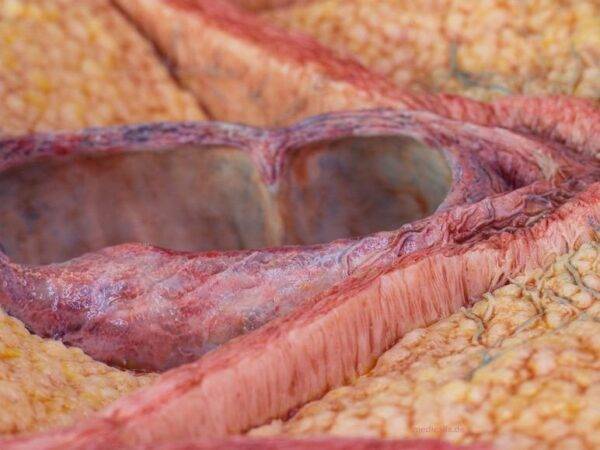 Das „Rahmenmodell Enddarm-Simulator“ von MEDICAL FX Germany ist ein hochwertiges, realistisches Trainingsmodell, das speziell für medizinische Schulungen und Übungen entwickelt wu…