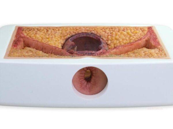 Das „Rahmenmodell Enddarm-Simulator“ von MEDICAL FX Germany ist ein hochwertiges, realistisches Trainingsmodell, das speziell für medizinische Schulungen und Übungen entwickelt wu…