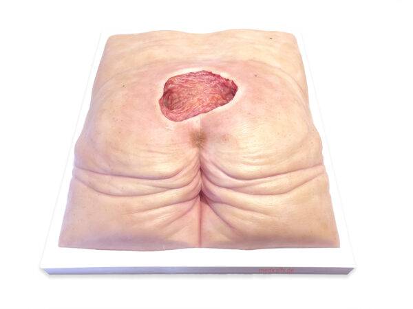 Das „Rahmenmodell Gesäß-Dekubitus" von MEDICAL FX Germany ist eine präzise Nachbildung eines fortgeschrittenen Druckgeschwürs im Sakralbereich, gefertigt aus hochwertigem Silikon.…