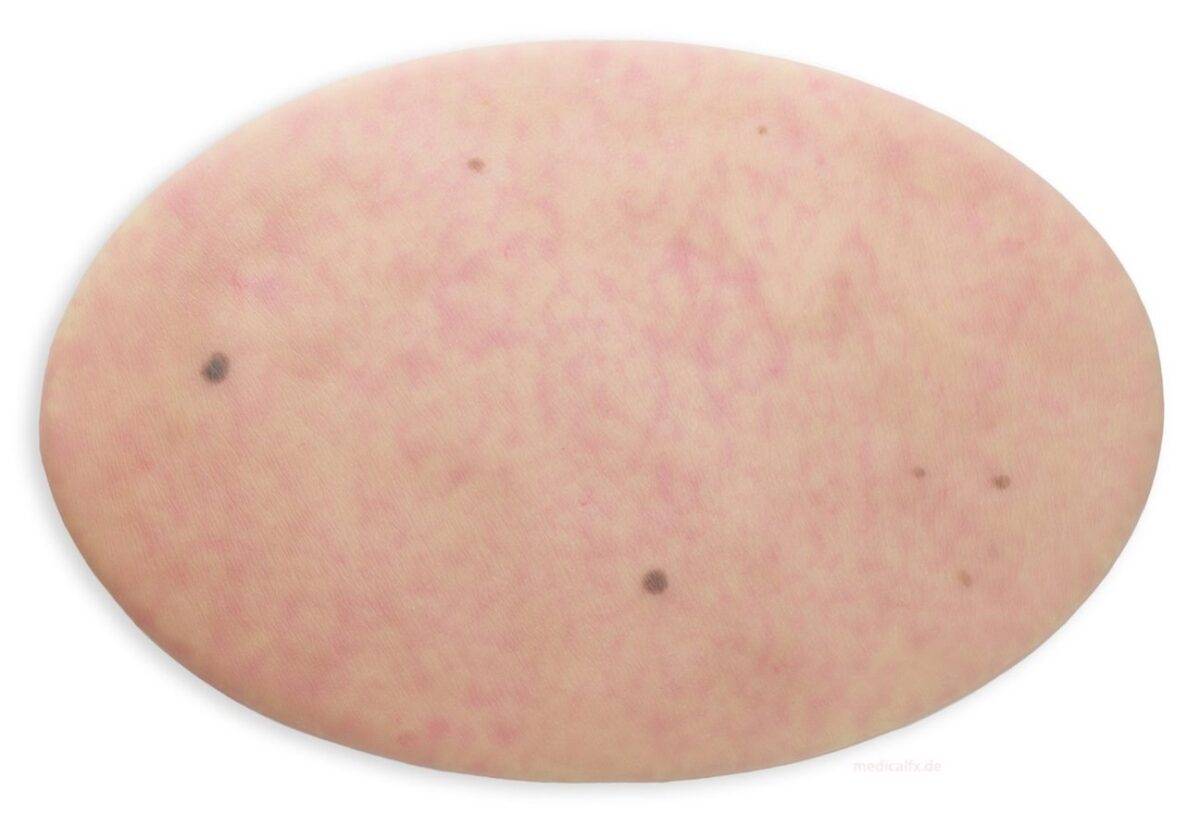 Das „Stick-On Medium Hautfläche ohne Wunden"-Modell von MEDICAL FX Germany bietet eine einzigartige Möglichkeit, die unversehrte menschliche Haut in Simulationen zu integrieren. E…