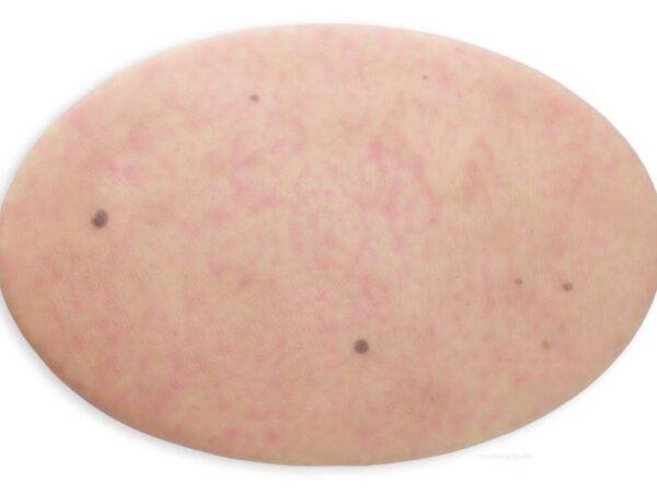 Das „Stick-On Medium Hautfläche ohne Wunden"-Modell von MEDICAL FX Germany bietet eine einzigartige Möglichkeit, die unversehrte menschliche Haut in Simulationen zu integrieren. E…