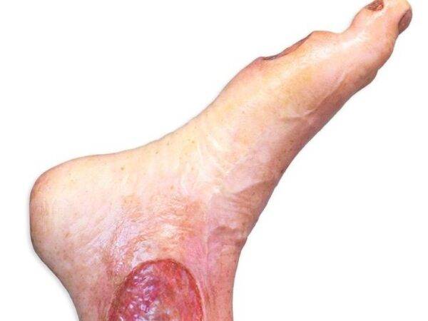 Das "Sockelmodell Bein mit 7 flachen Wunden" von MEDICAL FX Germany ist ein exzellentes Lehr- und Übungsinstrument für medizinisches Fachpersonal, um ein breites Spektrum an Wundv…