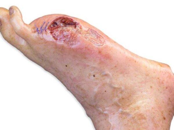 Das "Sockelmodell Bein mit 7 flachen Wunden" von MEDICAL FX Germany ist ein exzellentes Lehr- und Übungsinstrument für medizinisches Fachpersonal, um ein breites Spektrum an Wundv…