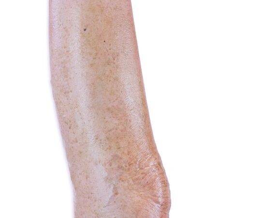 Das „Sockelmodell Bein mit 7 tiefen Wunden" von MEDICAL FX Germany ist ein exzellentes Lehr- und Übungsinstrument für medizinisches Fachpersonal, um ein breites Spektrum an Wundve…