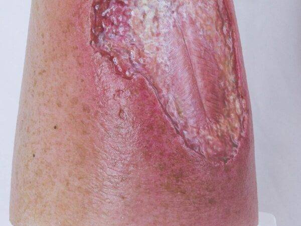 Das „Sockelmodell Bein mit 7 tiefen Wunden" von MEDICAL FX Germany ist ein exzellentes Lehr- und Übungsinstrument für medizinisches Fachpersonal, um ein breites Spektrum an Wundve…