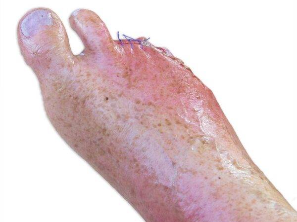 Das „Sockelmodell Bein mit 7 tiefen Wunden" von MEDICAL FX Germany ist ein exzellentes Lehr- und Übungsinstrument für medizinisches Fachpersonal, um ein breites Spektrum an Wundve…