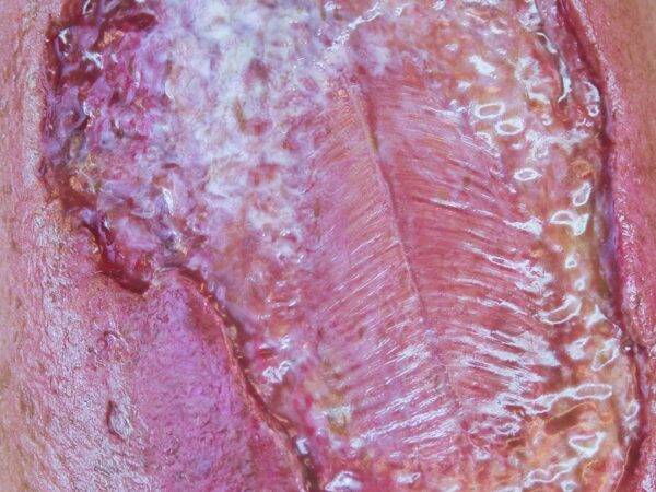 Das „Sockelmodell Bein mit 7 tiefen Wunden" von MEDICAL FX Germany ist ein exzellentes Lehr- und Übungsinstrument für medizinisches Fachpersonal, um ein breites Spektrum an Wundve…