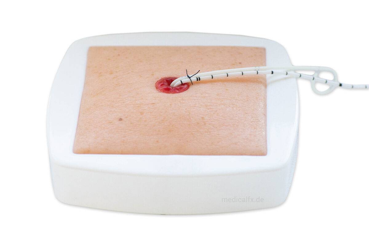 Das „Rahmenmodell Stoma auf Hautniveau“ von MEDICAL FX Germany bietet eine präzise und naturgetreue Darstellung eines Stomas, das exakt auf Hautniveau angelegt ist. Dieses Modell…