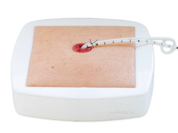 Das „Rahmenmodell Stoma auf Hautniveau“ von MEDICAL FX Germany bietet eine präzise und naturgetreue Darstellung eines Stomas, das exakt auf Hautniveau angelegt ist. Dieses Modell…