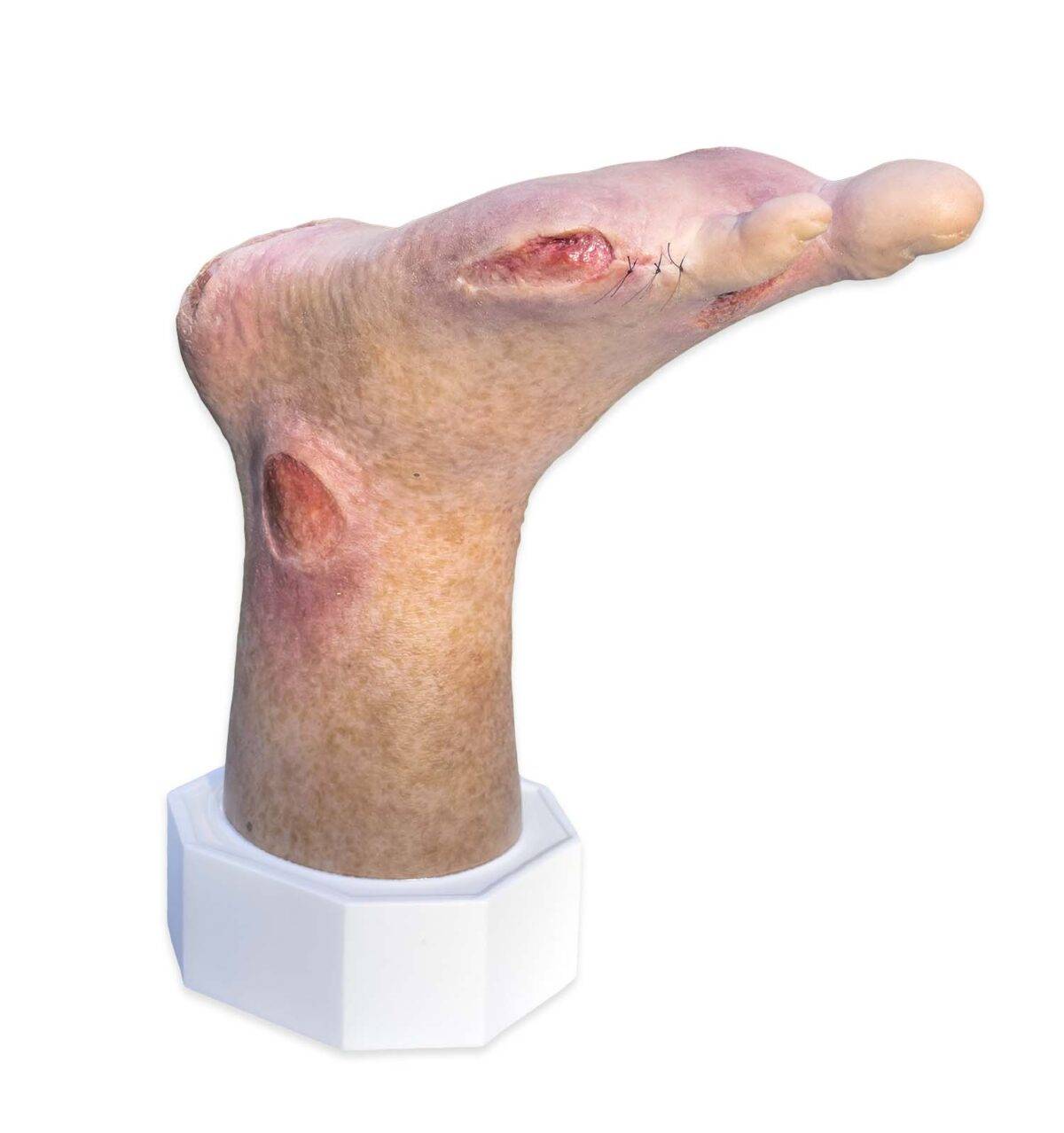 Das „Sockelmodell Zwei-Zehen-Fuß mit 6 Wunden“ von MEDICAL FX Germany präsentiert eine detailreiche Darstellung eines Fußes mit zwei verbliebenen Zehen und sechs verschiedenen Wun…