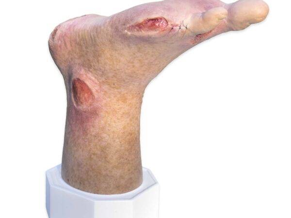 Das „Sockelmodell Zwei-Zehen-Fuß mit 6 Wunden“ von MEDICAL FX Germany präsentiert eine detailreiche Darstellung eines Fußes mit zwei verbliebenen Zehen und sechs verschiedenen Wun…