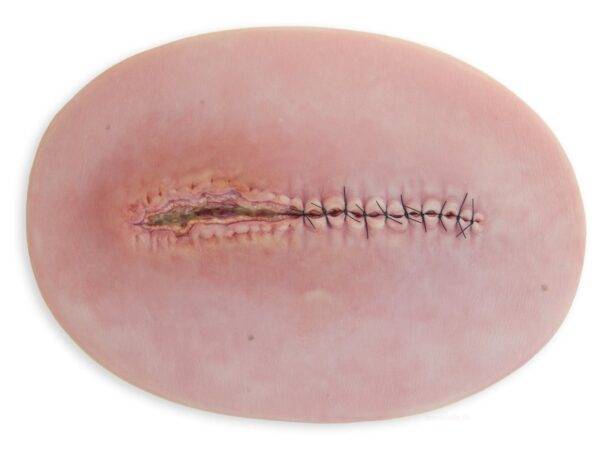 Das „Stick-On Medium OP Wunde, geöffnet"-Modell von MEDICAL FX Germany ist ein hochwertiges, mittelgroßes Silikonmodell zur Darstellung einer offenen Operationswunde. Es zeichnet…