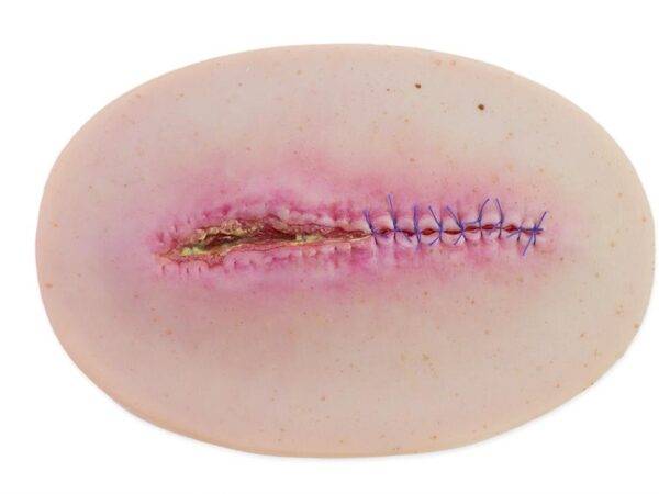 Das „Stick-On Medium OP Wunde, geöffnet"-Modell von MEDICAL FX Germany ist ein hochwertiges, mittelgroßes Silikonmodell zur Darstellung einer offenen Operationswunde. Es zeichnet…