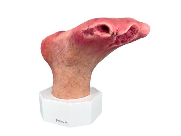 Das „Sockelmodell Diabetisches Fußsyndrom mit 7 Wunden" von MEDICAL FX Germany visualisiert präzise die Folgen des diabetischen Fußsyndroms. Die dargestellten Wunden umfassen Zehe…