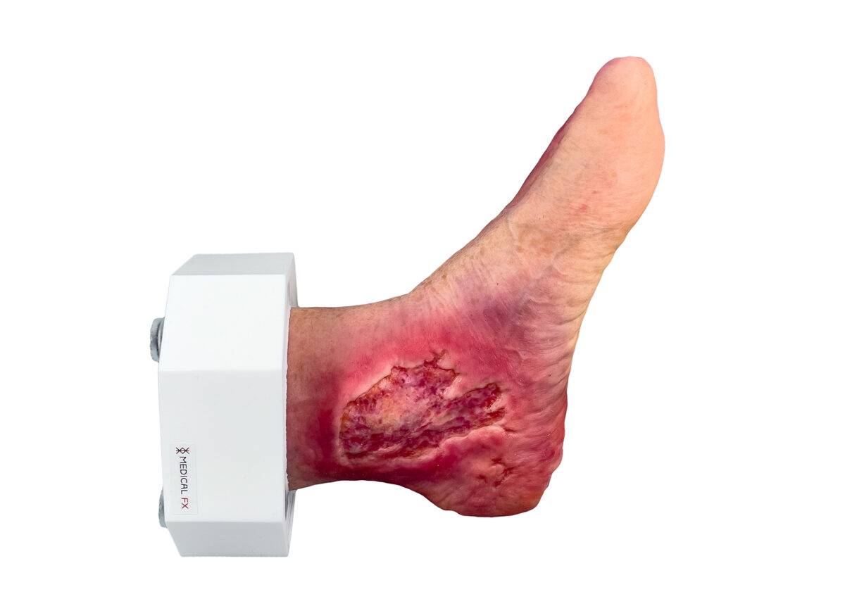 Das „Sockelmodell Diabetisches Fußsyndrom mit 7 Wunden" von MEDICAL FX Germany visualisiert präzise die Folgen des diabetischen Fußsyndroms. Die dargestellten Wunden umfassen Zehe…
