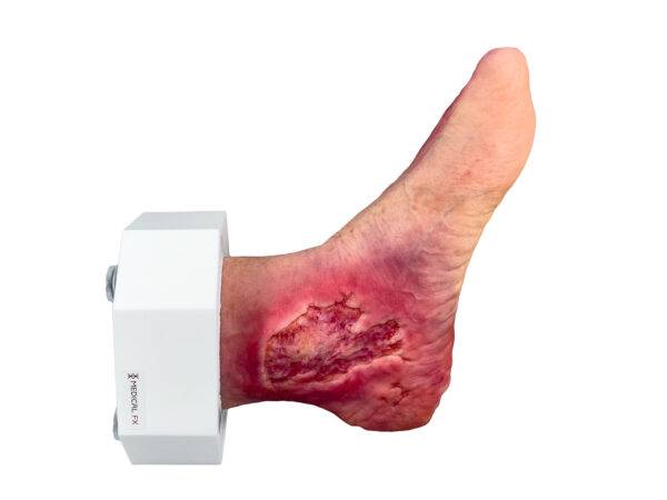 Das „Sockelmodell Diabetisches Fußsyndrom mit 7 Wunden" von MEDICAL FX Germany visualisiert präzise die Folgen des diabetischen Fußsyndroms. Die dargestellten Wunden umfassen Zehe…