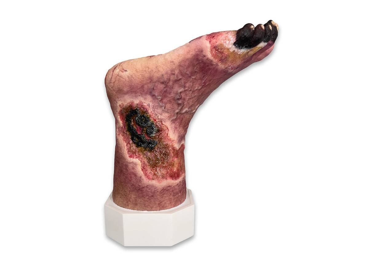 Das „Sockelmodell Nekrotischer Fuß" von MEDICAL FX Germany ist eine detailreiche Darstellung eines Fußes mit ausgeprägten nekrotischen Veränderungen. Dieses Modell ist auf einem S…