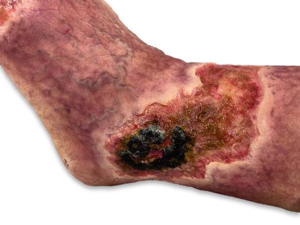Das „Sockelmodell Nekrotischer Fuß" von MEDICAL FX Germany ist eine detailreiche Darstellung eines Fußes mit ausgeprägten nekrotischen Veränderungen. Dieses Modell ist auf einem S…