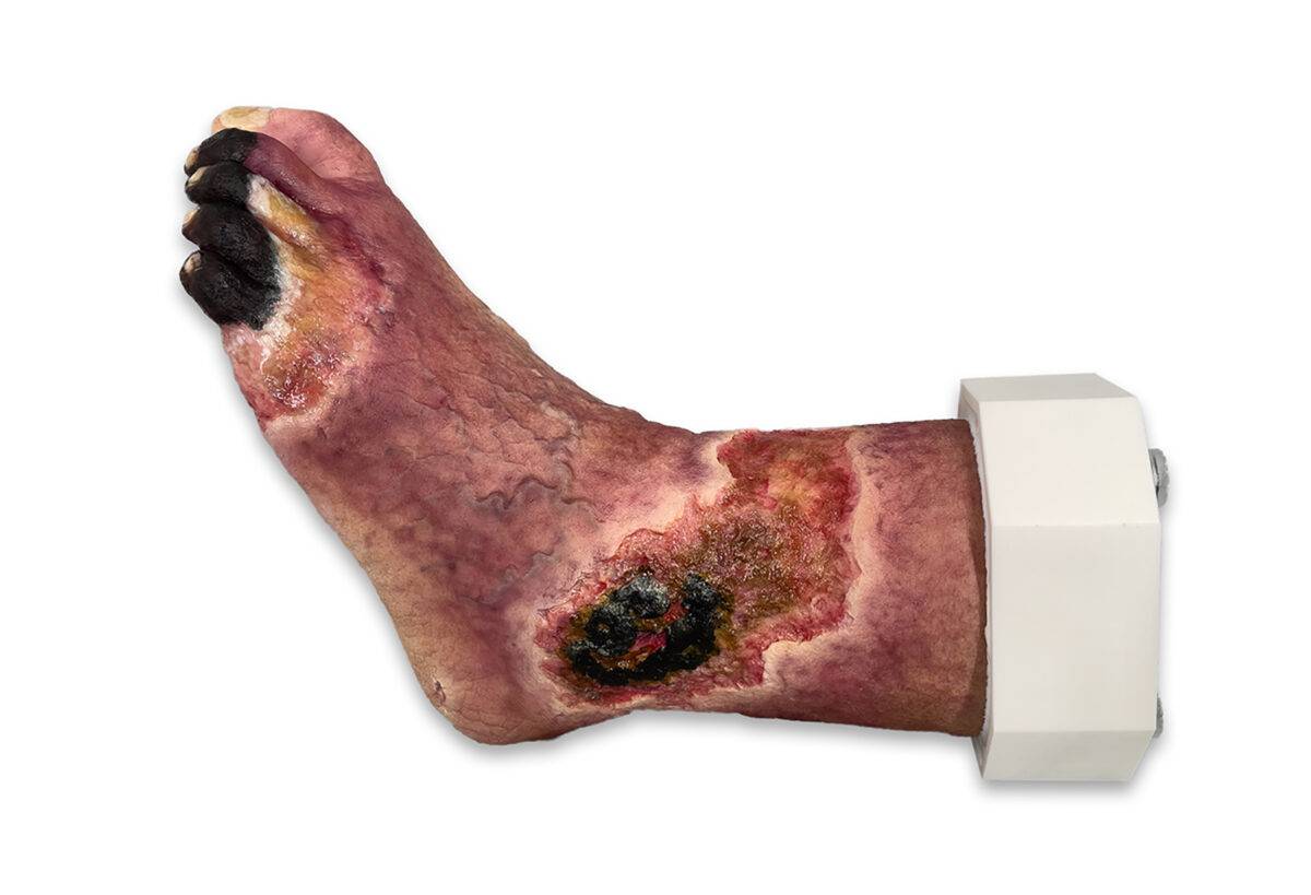 Das „Sockelmodell Nekrotischer Fuß" von MEDICAL FX Germany ist eine detailreiche Darstellung eines Fußes mit ausgeprägten nekrotischen Veränderungen. Dieses Modell ist auf einem S…
