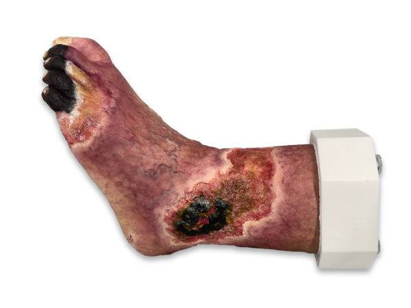 Das „Sockelmodell Nekrotischer Fuß" von MEDICAL FX Germany ist eine detailreiche Darstellung eines Fußes mit ausgeprägten nekrotischen Veränderungen. Dieses Modell ist auf einem S…