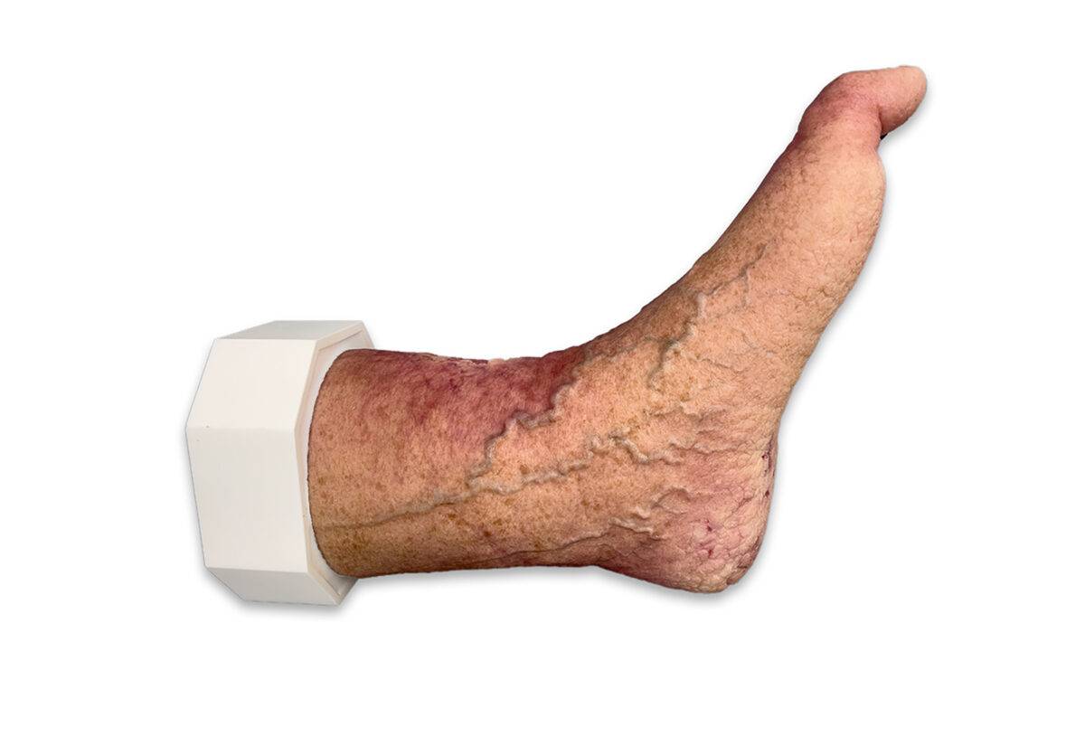 Das „Sockelmodell Nekrotischer Fuß" von MEDICAL FX Germany ist eine detailreiche Darstellung eines Fußes mit ausgeprägten nekrotischen Veränderungen. Dieses Modell ist auf einem S…