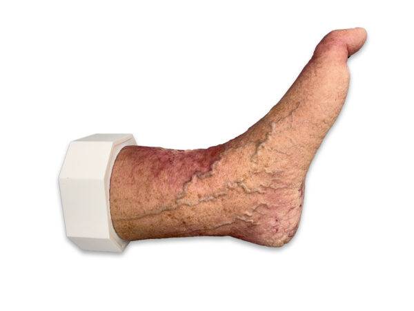 Das „Sockelmodell Nekrotischer Fuß" von MEDICAL FX Germany ist eine detailreiche Darstellung eines Fußes mit ausgeprägten nekrotischen Veränderungen. Dieses Modell ist auf einem S…