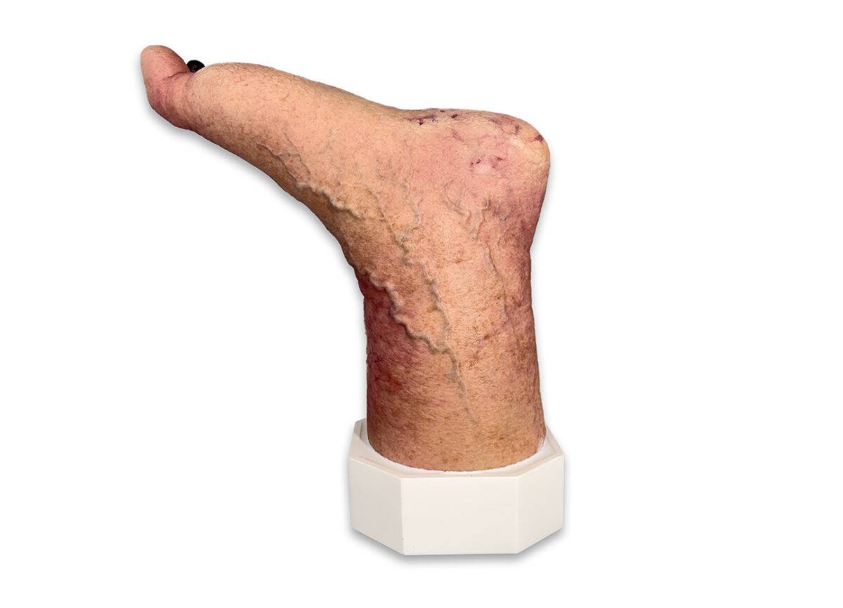 Das „Sockelmodell Nekrotischer Fuß" von MEDICAL FX Germany ist eine detailreiche Darstellung eines Fußes mit ausgeprägten nekrotischen Veränderungen. Dieses Modell ist auf einem S…