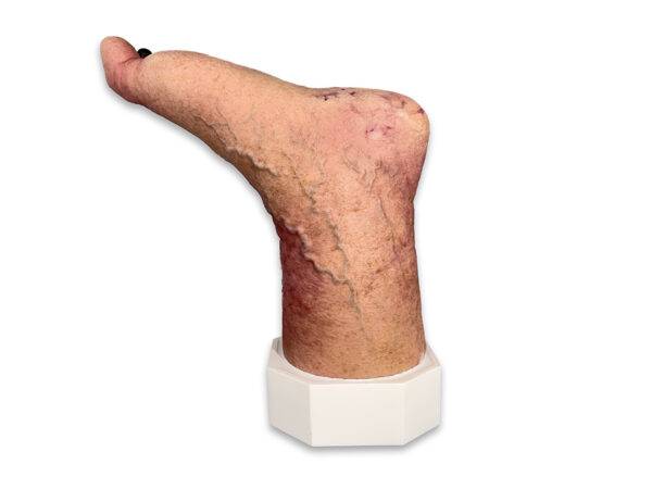 Das „Sockelmodell Nekrotischer Fuß" von MEDICAL FX Germany ist eine detailreiche Darstellung eines Fußes mit ausgeprägten nekrotischen Veränderungen. Dieses Modell ist auf einem S…