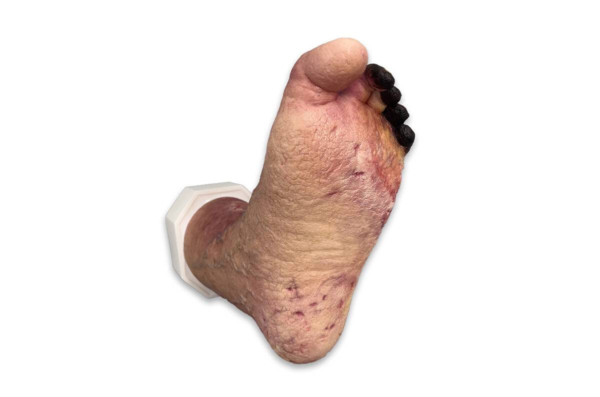 Das „Sockelmodell Nekrotischer Fuß" von MEDICAL FX Germany ist eine detailreiche Darstellung eines Fußes mit ausgeprägten nekrotischen Veränderungen. Dieses Modell ist auf einem S…