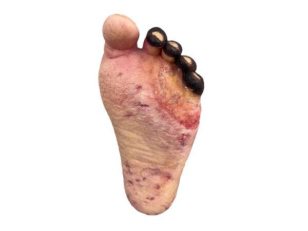 Das „Sockelmodell Nekrotischer Fuß" von MEDICAL FX Germany ist eine detailreiche Darstellung eines Fußes mit ausgeprägten nekrotischen Veränderungen. Dieses Modell ist auf einem S…