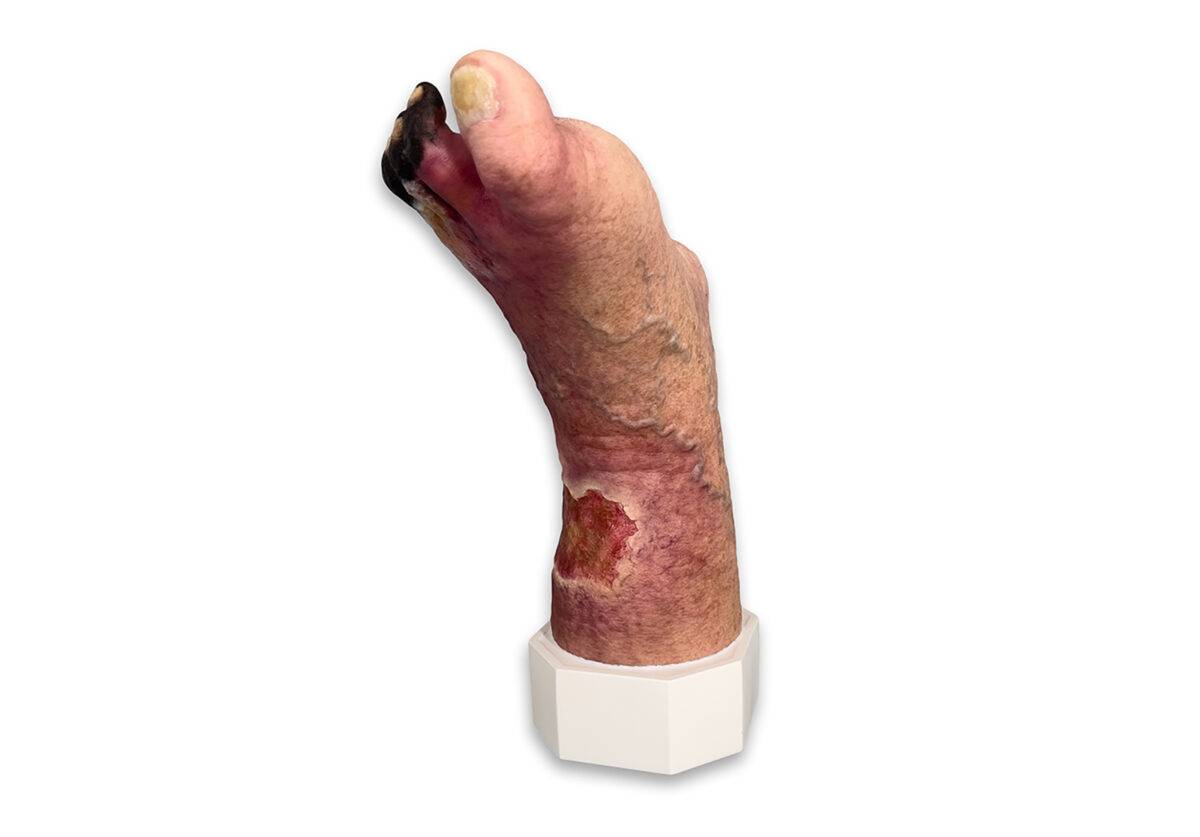 Das „Sockelmodell Nekrotischer Fuß" von MEDICAL FX Germany ist eine detailreiche Darstellung eines Fußes mit ausgeprägten nekrotischen Veränderungen. Dieses Modell ist auf einem S…