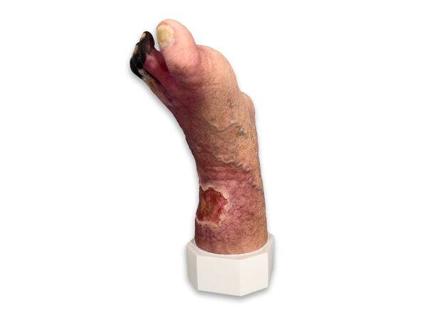 Das „Sockelmodell Nekrotischer Fuß" von MEDICAL FX Germany ist eine detailreiche Darstellung eines Fußes mit ausgeprägten nekrotischen Veränderungen. Dieses Modell ist auf einem S…