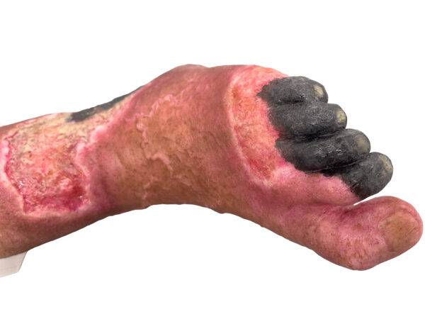 Das „Sockelmodell Nekrotischer Fuß" von MEDICAL FX Germany ist eine detailreiche Darstellung eines Fußes mit ausgeprägten nekrotischen Veränderungen. Dieses Modell ist auf einem S…