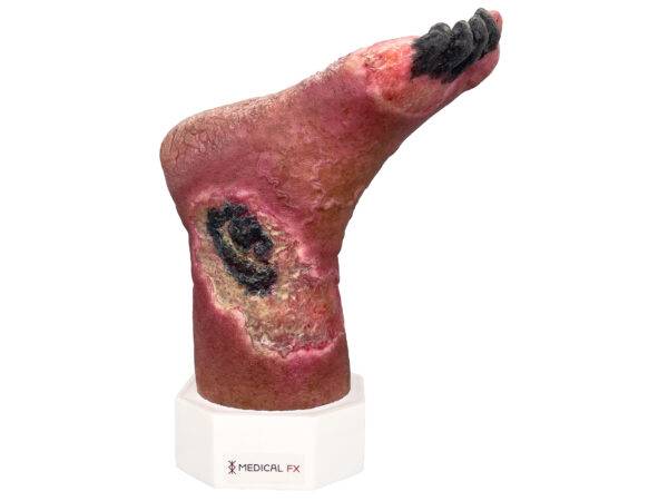 Das „Sockelmodell Nekrotischer Fuß" von MEDICAL FX Germany ist eine detailreiche Darstellung eines Fußes mit ausgeprägten nekrotischen Veränderungen. Dieses Modell ist auf einem S…