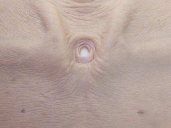 Das „Stick-On Large Tracheostoma"-Modell von MEDICAL FX Germany simuliert realistisch einen Luftröhrenschnitt und besteht aus hochwertigem Silikon. Konzipiert zur Befestigung an L…