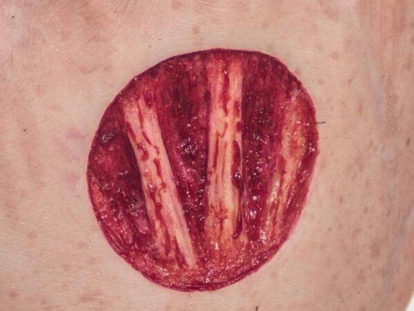 Das „Sockelmodell Arm mit offenliegenden Sehnen" von MEDICAL FX Germany ist eine anatomische Darstellung, die speziell zur Visualisierung der komplexen Sehnenstrukturen des mensch…