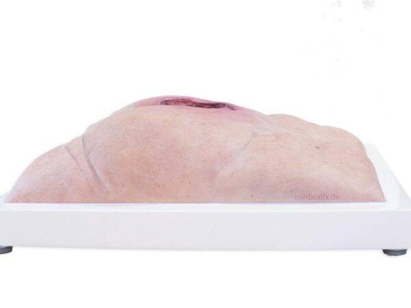 Das „Rahmenmodell Gesäß-Dekubitus" von MEDICAL FX Germany ist eine präzise Nachbildung eines fortgeschrittenen Druckgeschwürs im Sakralbereich, gefertigt aus hochwertigem Silikon.…