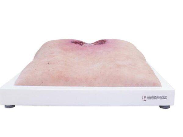 Das „Rahmenmodell Gesäß-Dekubitus" von MEDICAL FX Germany ist eine präzise Nachbildung eines fortgeschrittenen Druckgeschwürs im Sakralbereich, gefertigt aus hochwertigem Silikon.…