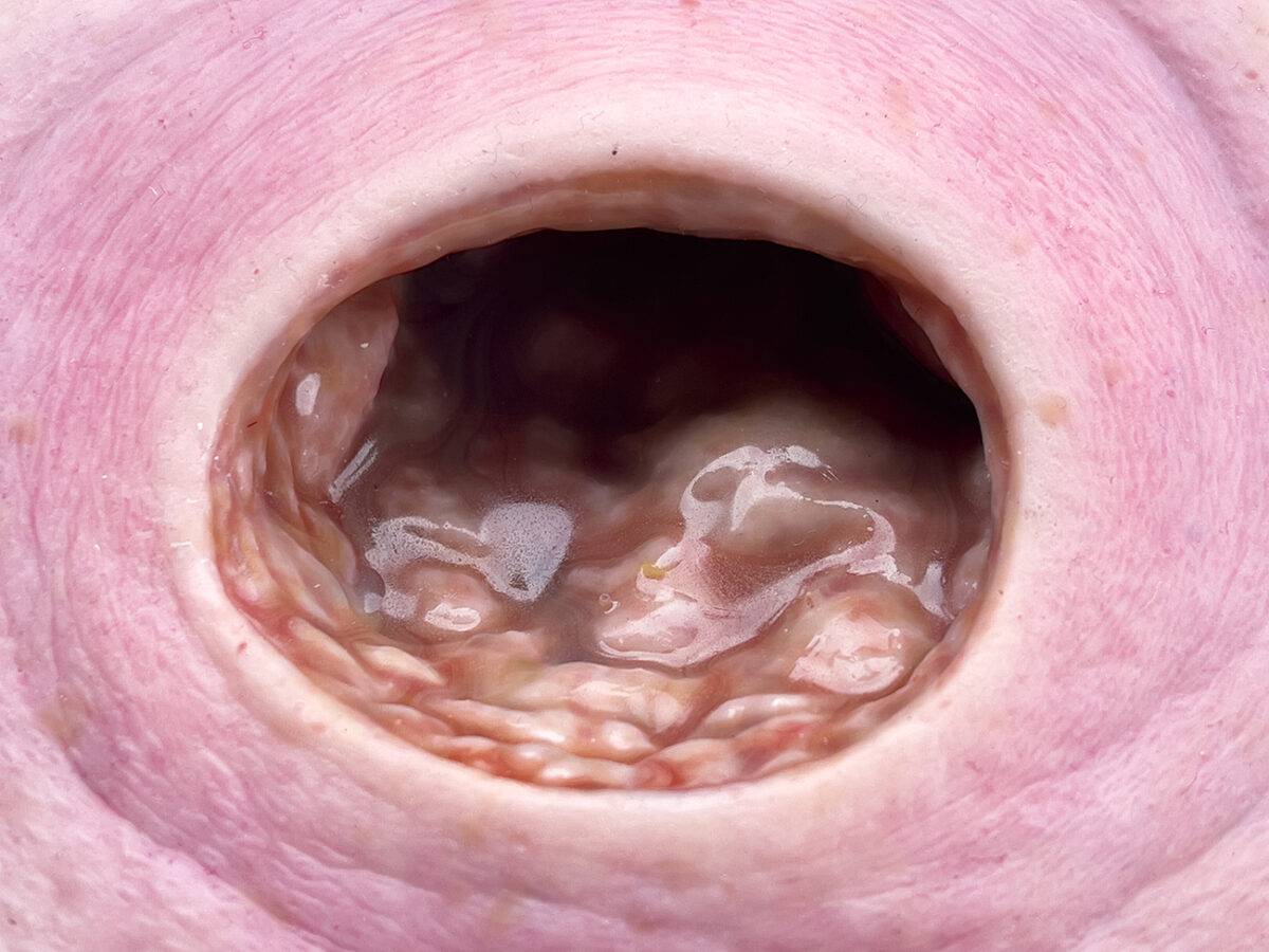 Das „Rahmenmodell Dekubitus mit glattem Wundrand" von MEDICAL FX Germany bietet eine exakte und realistische Darstellung eines Dekubitus mit charakteristisch glatten Wundrändern.…